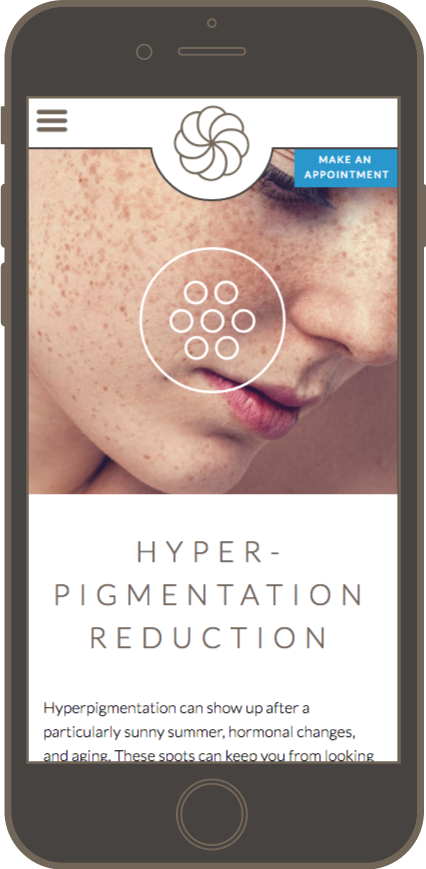 Mockup of Dr. Sugimoto Med Spa hyperpigmentation services page